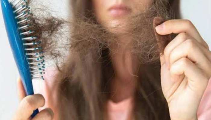Best Hair Loss Treatments